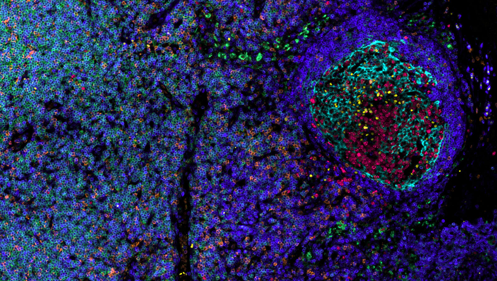 IBEX Image of a Lymph Node