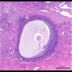 Antral Follicle w/Ovum Inside