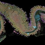 Xenium 5k Image of the Duodenum Region of the Small Intestine