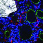 MIBI-TOF Image of Bone Marrow