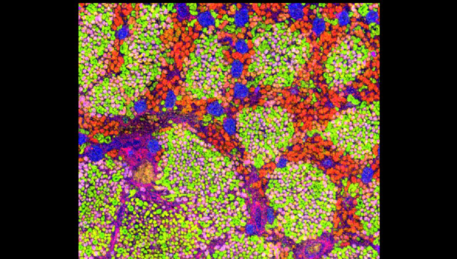 MALDI and Microscopy Lipid Atlas of the Human Kidney